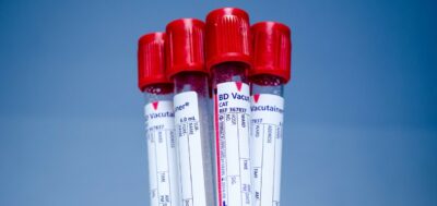 Doação de Sangue e Medula