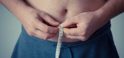 Tratamento farmacológico para a obesidade ainda não está acessível a todos em Portugal