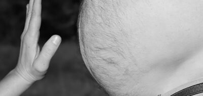 1,5 milhões de obesos em Portugal