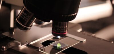 Cientistas descobriram um novo método para tratar a obesidade